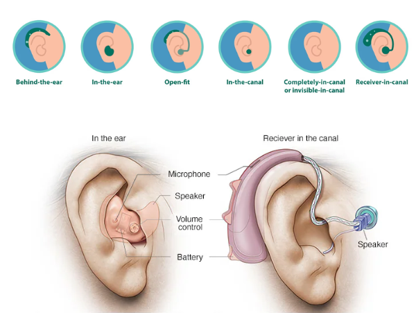 Hearing aid center in Vizag